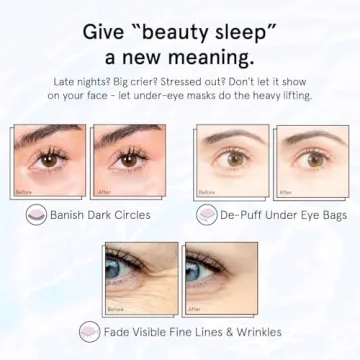 grace & stella Under Eye Patches for Puffy Eyes and Dark Circles (Retinol, 6 Pairs) Restoring Gel Under Eye Masks with Hyaluronic Acid - Vegan Cruelty-Free Skincare Birthday Gifts for Women