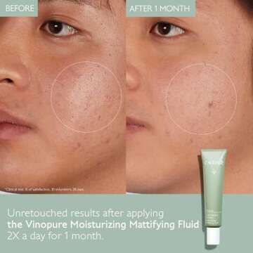 Caudalie Vinopure Oil Control Moisturizer for Acne Prone Skin, Hydrating & Mattifying Moisturizer, 1...