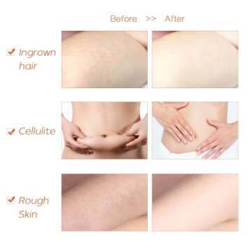 ICANdOIT Dry Brushing Body Brush-Stiff Sisal Bristles Dry Skin Brush,Exfoliating Massage Brush for Cellulite and Lymphatic,Improve Circulation,Stop Ingrown Hairs,Reduce Acne,Soften Skin