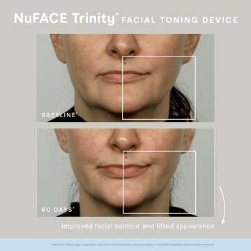 NuFACE Trinity Device with Lip & Eye Attachment Set