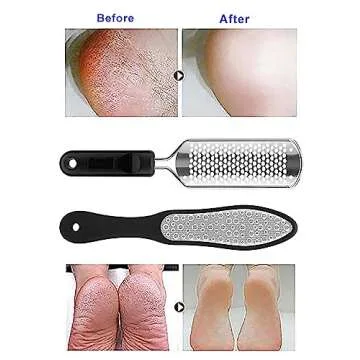 Oneleaf Foot File Professional Pedicure Rasp Cracked Skin Corns Callus Remover for Extra Smooth and Beauty Foot 2PCS