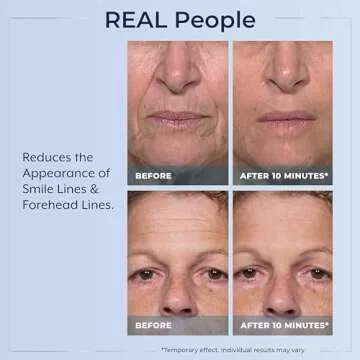 Plexaderm Rapid Reduction Eye Serum - Visibly Reduces Under-Eye Bags, Wrinkles, Dark Circles, Fine Lines & Crow's Feet Instantly, Anti Aging Wrinkle Remover for Face, Full Size Tube