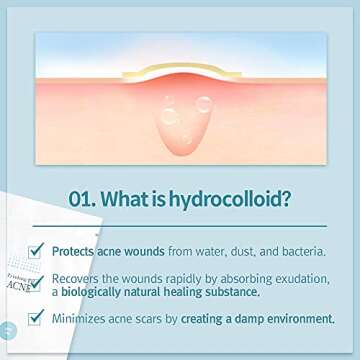 Pyunkang Yul ACNE Spot Patches Super Thin 60 Count - Consistent Adhesiveness Hydrocolloid Pimple Patches - Acne Treatment for Face - Semicircular Bending Method – K-beauty Facial Skin Care Products…