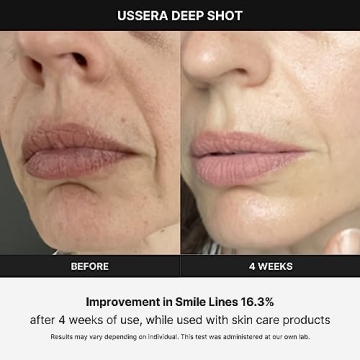 Medicube Age-R USSERA Facial Treatment Device for Youthful Skin