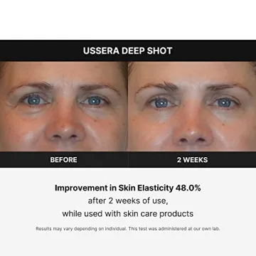 Medicube Age-R USSERA Facial Treatment Device for Youthful Skin