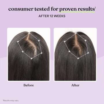 Lemme Grow Hair Growth Supplement for Women, Clinically Proven Keratin Complex for Visibly Thicker Hair and Scalp Coverage, Reduced Shedding, Nourish Thinning Hair - 1 Month Supply