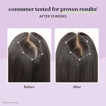 Lemme Grow Hair Growth Supplement for Women, Clinically Proven Keratin Complex for Visibly Thicker Hair and Scalp Coverage, Reduced Shedding, Nourish Thinning Hair - 1 Month Supply