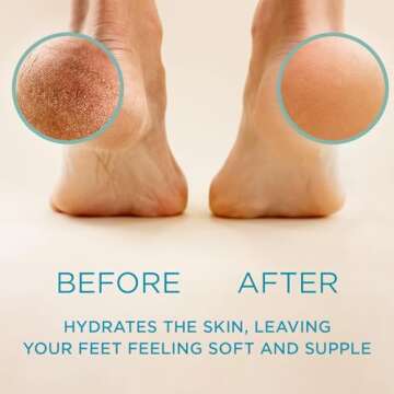 Lee Beauty Professional Callus Remover for Feet - Extra Strength Gel & Rasp Foot File Kit - Original...