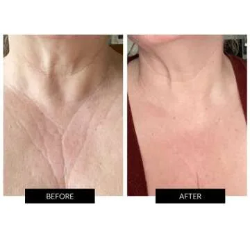 CurrentBody Skin Complete LED Kit | Fully Wearable Anti-Aging LED Mask & Device for Face, Neck & Décolletage | Red Light Therapy Treatment Device for Wrinkle Reduction