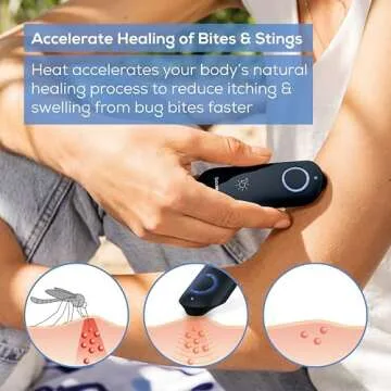 Beurer BR90 Insect Sting and Bite Relief with Light, Chemical-Free Bug Bite Healer for Day and Night, Electronic Heat Device for After Mosquito Bites to Ease Itching and Swelling