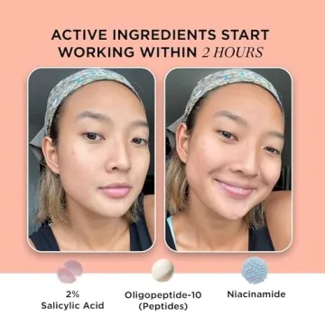 ZitSticka Killa Acne Patches - Fast-Acting Microdart Solution for Zits