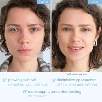 Baebody Snail Mucin Face Sheet Mask (6 pcs) - Anti Aging and Moisturizing Face Mask with Hyaluronic Acid - Deep Hydration for Youthful Skin