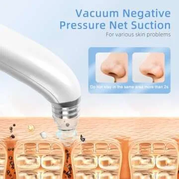 Blackhead Remover Vacuum with HD Camera and 5 Speeds