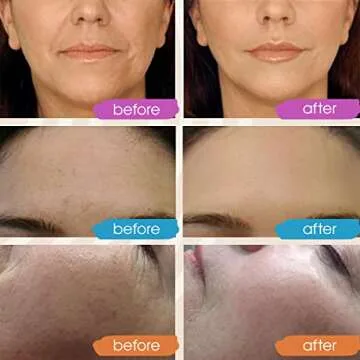 GLEOW Retinol Serum for Face, Vitamin C with Hyaluronic Acid Face Serum for Women and Men, Glow Skin Care Set Targets Appearance of Uneven Skin Tone and Dryness 3x1oz