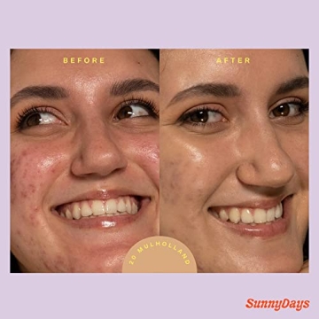 Tower 28 SPF Tinted Sunscreen for Sensitive Skin - 2-in-1