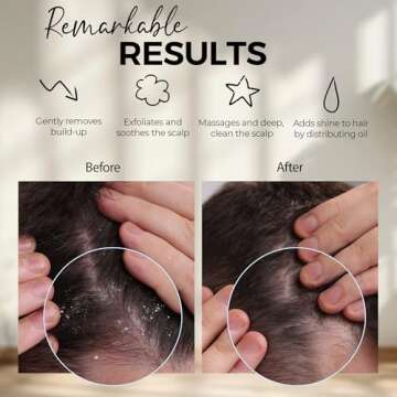 Fiora Naturals Scalp Massager Brush - Dandruff Removal & Growth Stimulator for All Hair Types