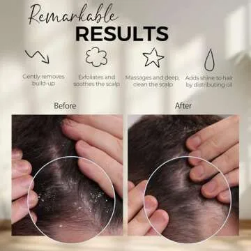 Fiora Naturals Scalp Massager Brush - Dandruff Removal & Growth Stimulator for All Hair Types