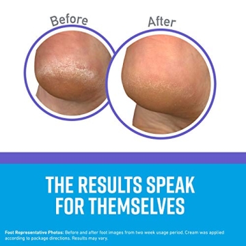 O'Keeffe's Night Treatment Combo for Soft Skin