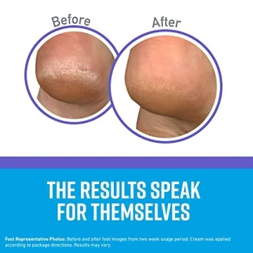 O'Keeffe's Night Treatment Combo for Soft Skin