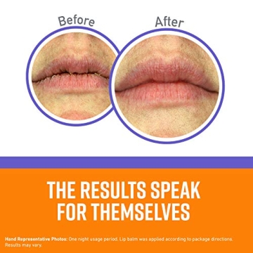 O'Keeffe's Night Treatment Combo for Soft Skin