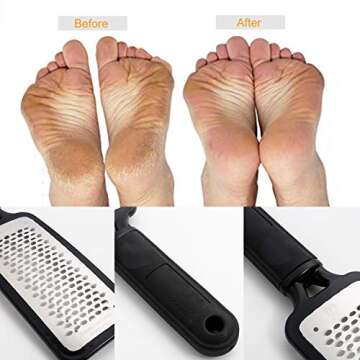 Professional Foot Scrubber Callus Remover for Soft Feet