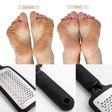 Professional Foot Scrubber Callus Remover for Soft Feet