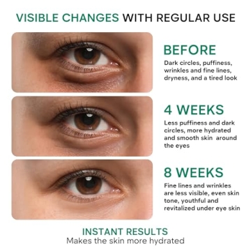 Best Eye Cream for Dark Circles and Puffiness