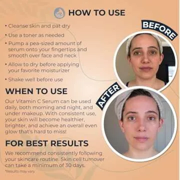 Vitamin C Face Serum - Anti Aging & Brightening Facial Serum - With Hyaluronic Acid Gotu Kola & Jojoba Oil - Natural & Organic - Foxbrim Naturals 1oz