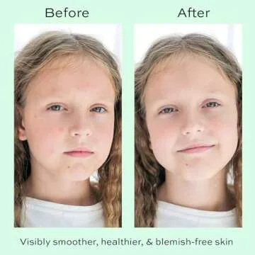 Face Moisturizer for Kids with Hyaluronic Acid - 50ml
