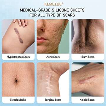 Silicone Scar Sheets,1.6"x120"- Silicone Scar Tape,Medical Scar Removal Strips for Keloid,Tummy Tuck...