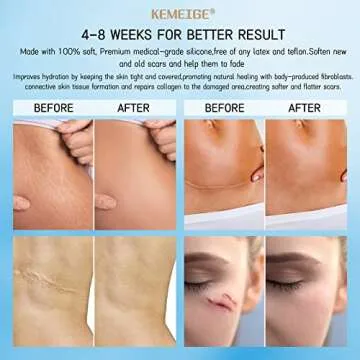 Silicone Scar Sheets,1.6"x120"- Silicone Scar Tape,Medical Scar Removal Strips for Keloid,Tummy Tuck,Acne Removal Treatment,Post Surgery Supplies 7-8 Month Supply