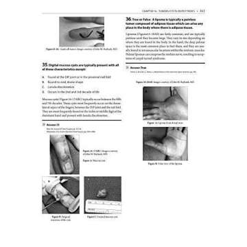 Hand and Upper Extremity Rehabilitation Guide Book