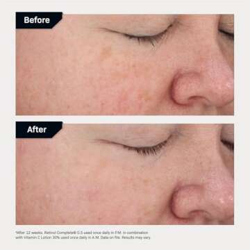 Revision Skincare Vitamin C Lotion 30%, Daily Anti Aging Brightening and Moisturizing Lotion for Fine Lines and Wrinkles, 1 fl oz