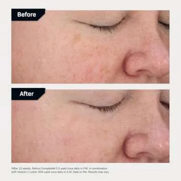 Revision Skincare Vitamin C Lotion 30%, Daily Anti Aging Brightening and Moisturizing Lotion for Fine Lines and Wrinkles, 1 fl oz