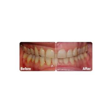 ProBiora Kids Chewable Probiotics for Healthier Teeth