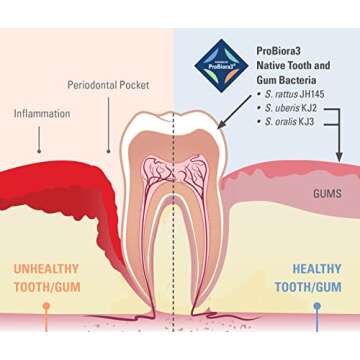 ProBiora Kids Chewable Probiotics for Healthier Teeth