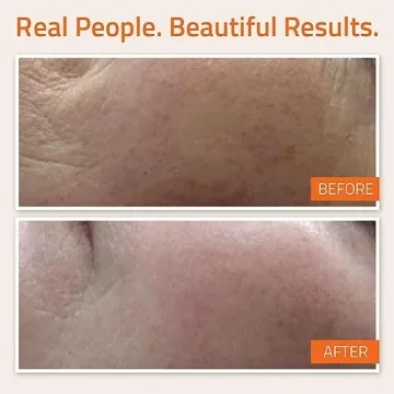 YEOUTH Vitamin C Serum with E and Hyaluronic Acid 2oz