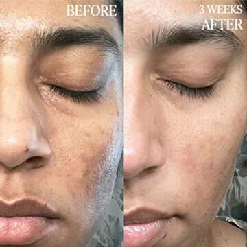 BYROE Kiwi Gel Cleanser | Foaming Face Wash with AHA and BHA | Exfoliating Salicylic Acid to Help Prevent Breakouts | Balance Redness, Blackheads and Clogged Pores | Vegan, 65 ML