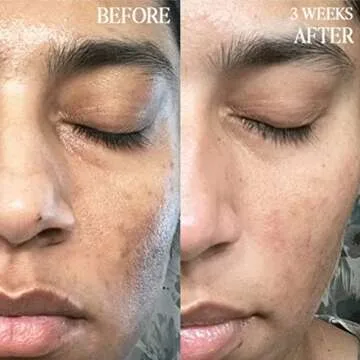 BYROE Kiwi Gel Cleanser | Foaming Face Wash with AHA and BHA | Exfoliating Salicylic Acid to Help Prevent Breakouts | Balance Redness, Blackheads and Clogged Pores | Vegan, 65 ML