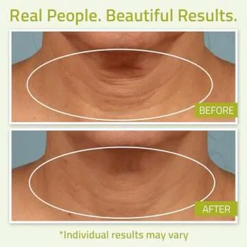 YEOUTH Neck Cream with Vitamin C, Moisturizing Neck Firming Cream for Women and Men, Targeting Decolletage and Double Chin, Cleavage and Chest 2oz