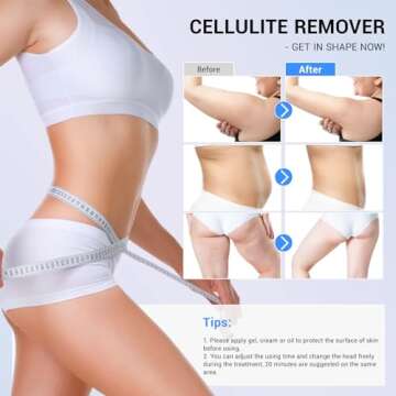 MEIQIER Sens Cellulite Device – Radio Frequency Massager for Improved Skin Appearance