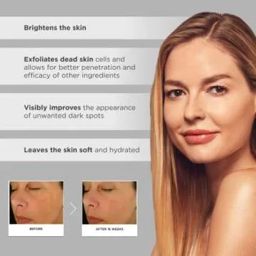 Glytone Enhance Brightening Complex with Azelaic & Glycolic Acid