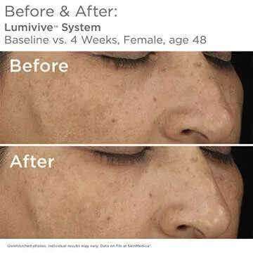 SkinMedica Lumivive Day & Night System for Radiant Skin