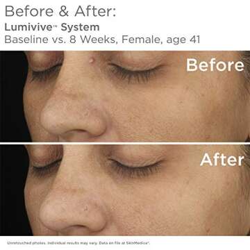 SkinMedica Lumivive Day & Night System for Radiant Skin