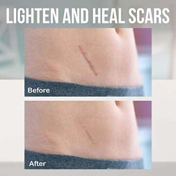 Silicone Scar Sheets for Effective Scar Treatment