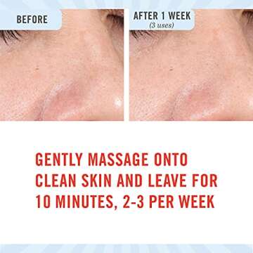 First Aid Beauty FAB Pharma Calamine Pore Purging Mask – Detoxifying Face Mask with Calamine, Kaolin Clay, Bentonite Clay and Salicylic Acid – 2.5 oz