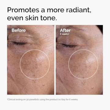 The Ordinary Glycolic Acid 7% Exfoliating Toner, Brightening and Smoothing Daily Toner for More Even...