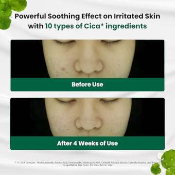 Dr.G Red Blemish Clear Soothing Cream, 70ml - Moisturizing Recovery Cream for Sensitive Acne-Prone Skin; Cica Soothing Moisturizer, Korean Skin Care, Korean Skincare, Kbeauty, K Beauty, Korean Beauty