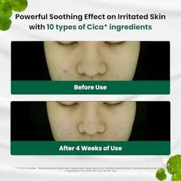 Dr.G Red Blemish Clear Soothing Cream, 70ml - Moisturizing Recovery Cream for Sensitive Acne-Prone Skin; Cica Soothing Moisturizer, Korean Skin Care, Korean Skincare, Kbeauty, K Beauty, Korean Beauty