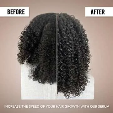 Hair Growth Serum, Hair Treatment For Women 1 FL Oz (30 mL) (Pack Of 1)